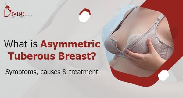 What is Asymmetric Tuberous Breast - Symptoms, Causes and Treatment