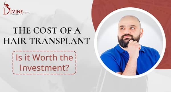 The Cost of a Hair Transplant Is it Worth the Investment