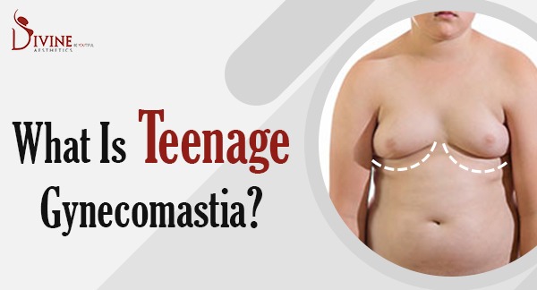 What Is Teenage Gynecomastia - GIT
