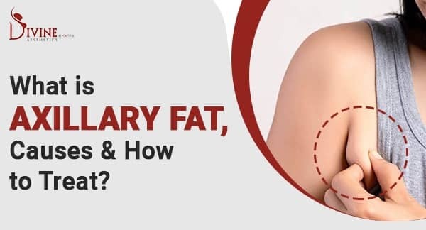 What is Axillary Fat, Causes & How to Treat Axillary Fat