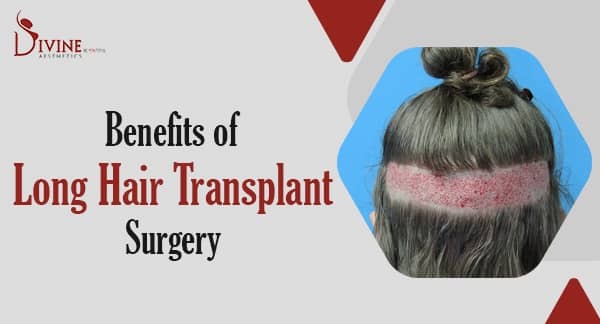Benefits of Long Hair Transplant Surgery