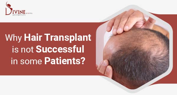 Why Is Hair Transplant Not Successful in Some Patients?