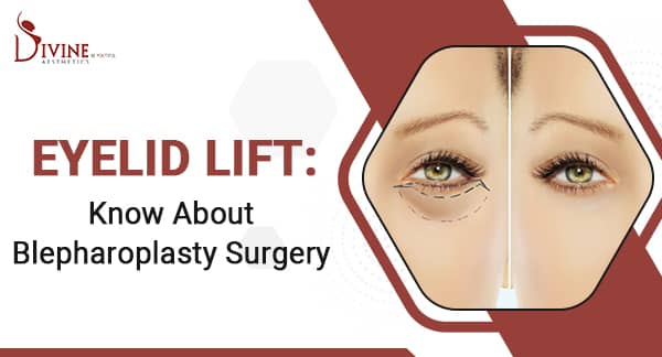Eyelid Lift: Everything You Should Know About Blepharoplasty Surgery