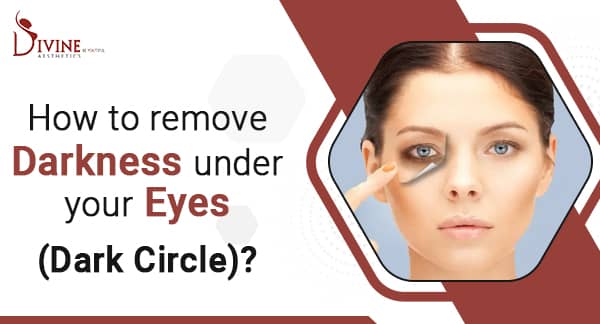 Dark Circles Under the Eye : Reasons and Treatments