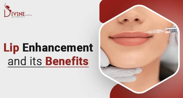 Lip Fillers - Lip Enhancement in India - Benefits of Lip Augmentation