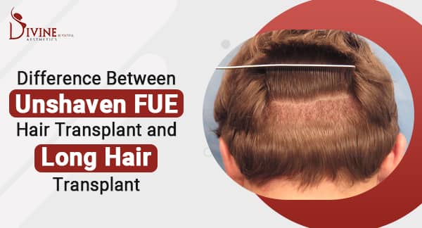 Unshaven FUE Hair Transplant Vs Long Hair Transplant
