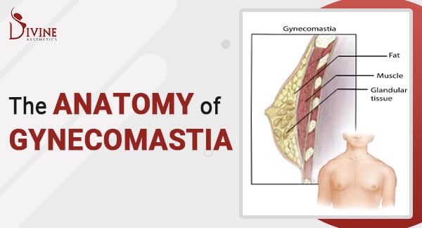 Gynecomastia or Male Breast Anatomy and Treatment Option