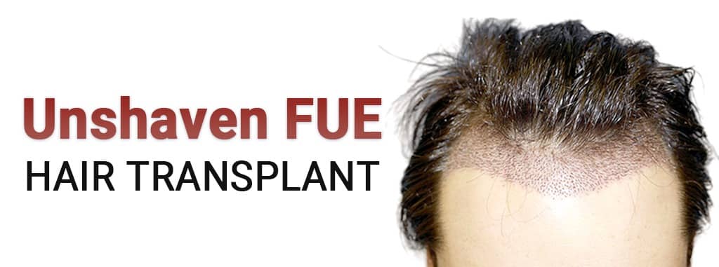 Unshaven FUE hair transplant in India