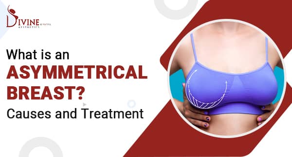 What is Asymmetrical Breast, its Causes, and Treatment in India