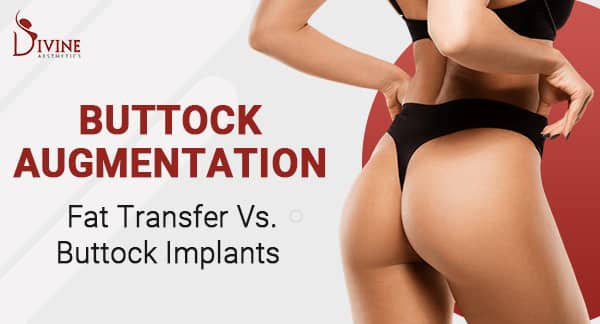 Buttock Augmentation in India – Fat Transfer Vs. Buttock Implants