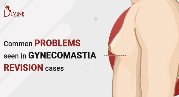 Common Problems Seen in Gynecomastia Revision Cases