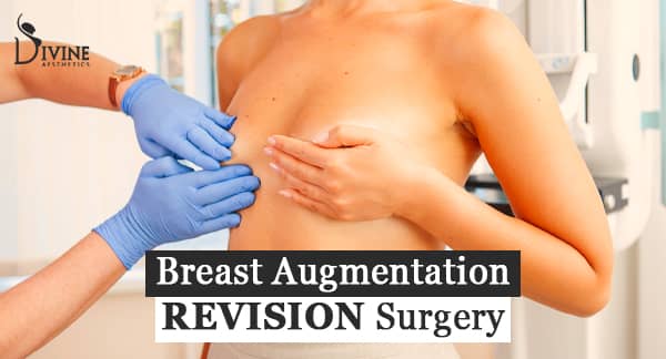 Reasons for Breast Augmentation Revision Surgery