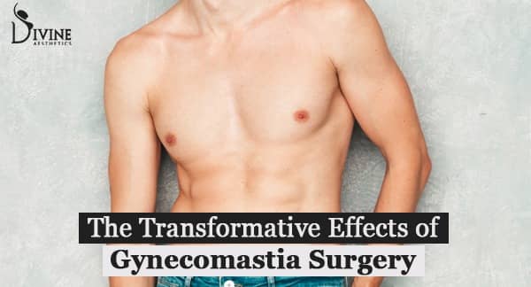 The Transformative Effects of Gynecomastia Surgery