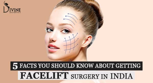 5 Facts You Should Know About Getting Facelift Surgery in India