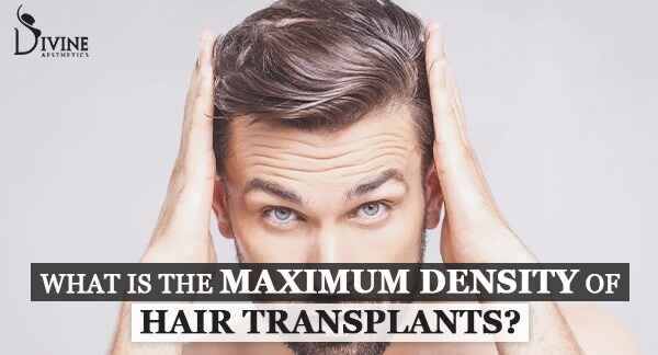 maximum density of hair transplant