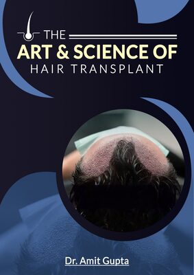 Download Hair Transplant Expert E Guidebook - Dr. Amit Gupta