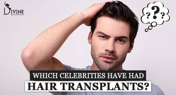 Which Celebrities have had Hair Transplants