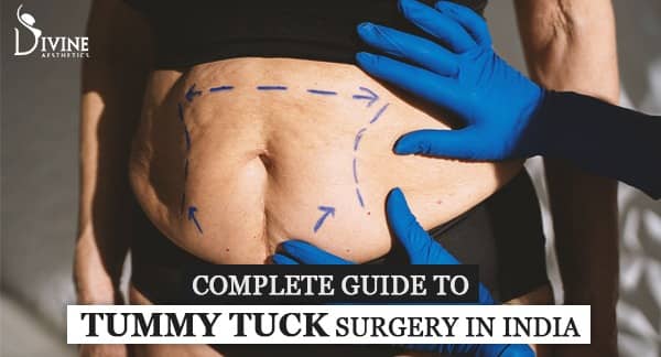 Complete Guide to Tummy Tuck Surgery in Delhi