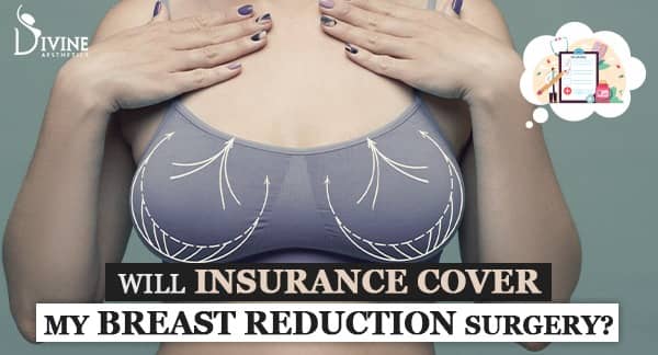 Will Insurance Cover a Breast Reduction Surgery?