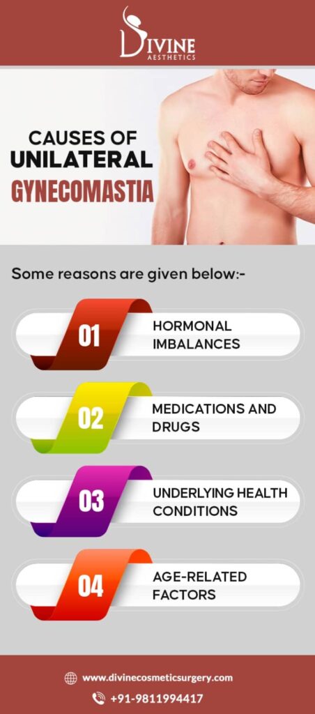 Causes of Unilateral Gynecomastia