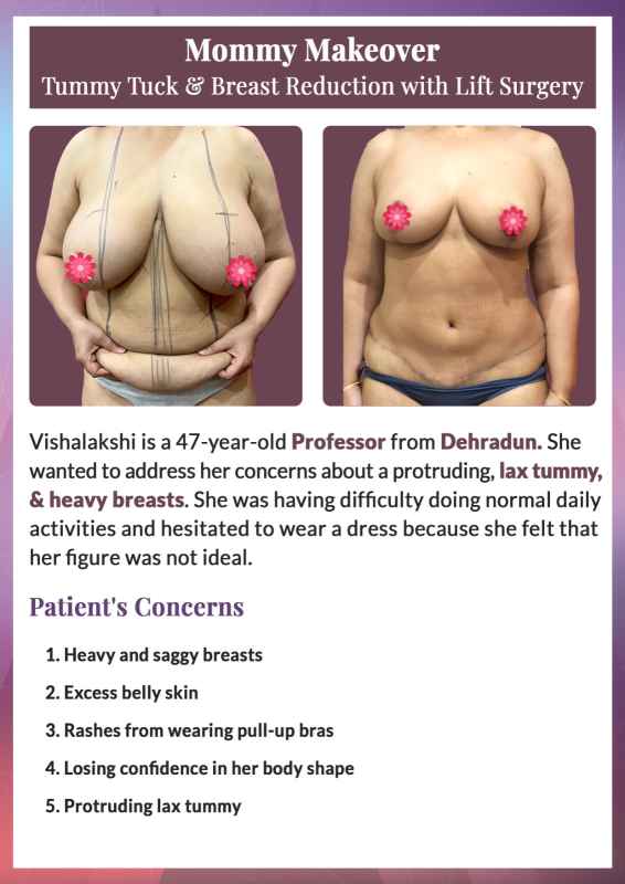 mommy makeover surgery results India