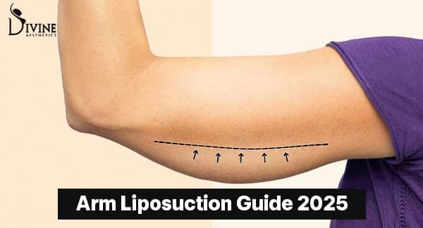 Arm Liposuction Guide 2025