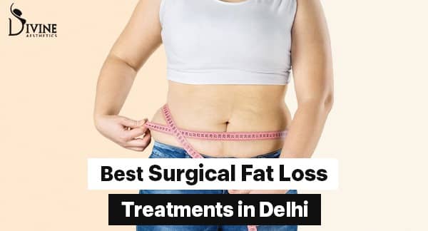 Best Surgical Fat Loss Treatments in Delhi