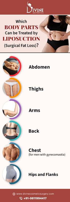 Which body parts can be treated with liposuction