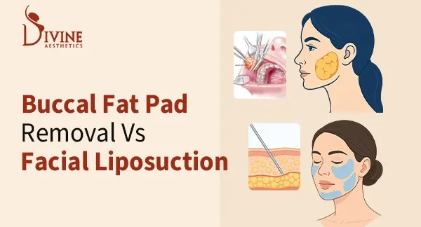 Buccal Fat Pad Removal vs Facial Liposuction