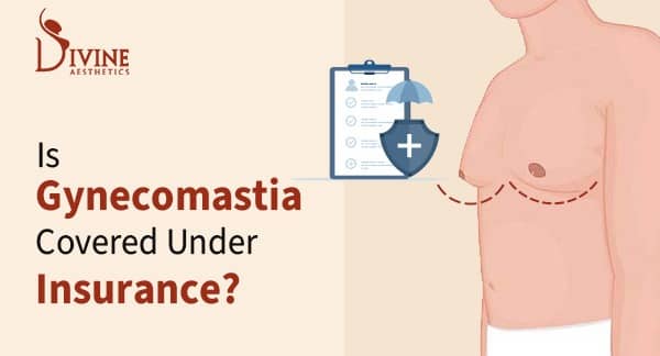 Is Gynecomastia Covered Under Insurance in