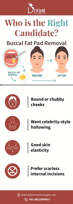 Right candidate for buccal fat pad reduction