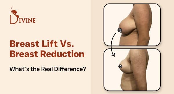 Breast Lift vs. Breast Reduction - What’s the Real Difference