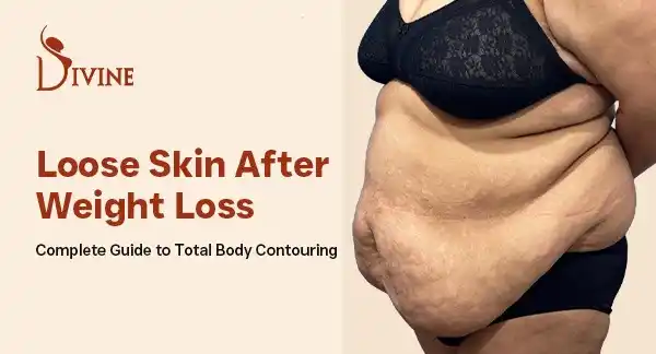 Loose Skin After Weight Loss Complete Guide Body Reshaping