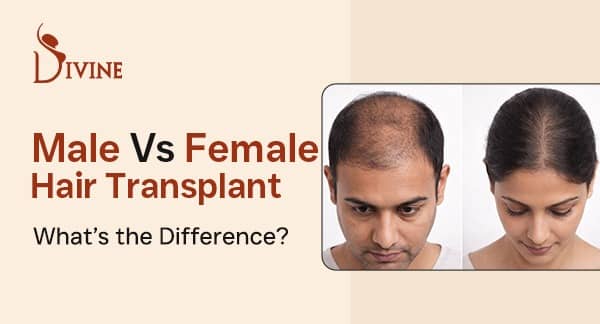 Female Hair Transplant vs Male Hair Transplant