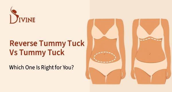 Reverse Tummy Tuck vs Tummy Tuck