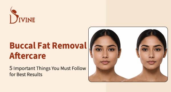Buccal Fat Removal Aftercare