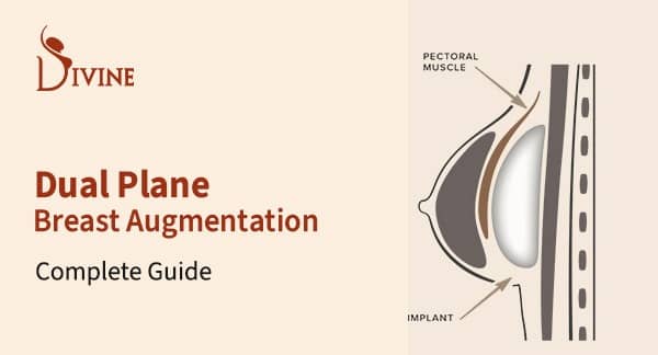 Dual Plane Breast Augmentation