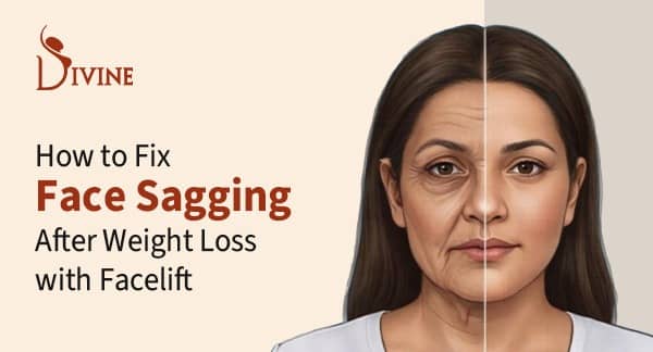 Facelift After Weight Loss Best Treatment to Fix Face Sagging