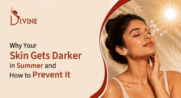 why skin gets darker in summer