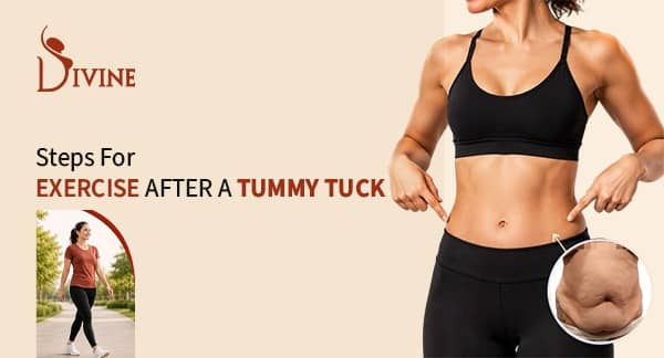 exercise after tummy tuck recovery timeline
